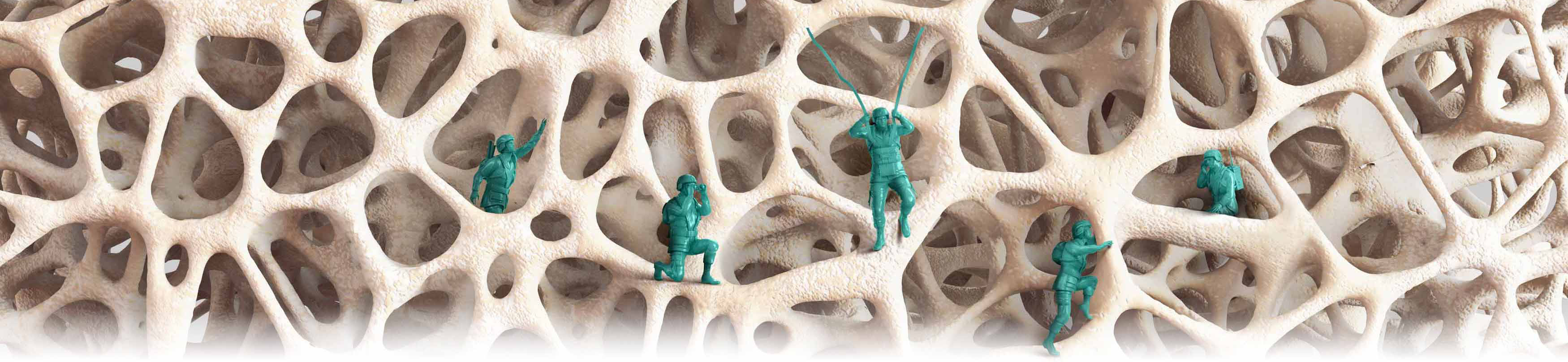 Composite image of green toy soldiers deployed inside a bone matrix